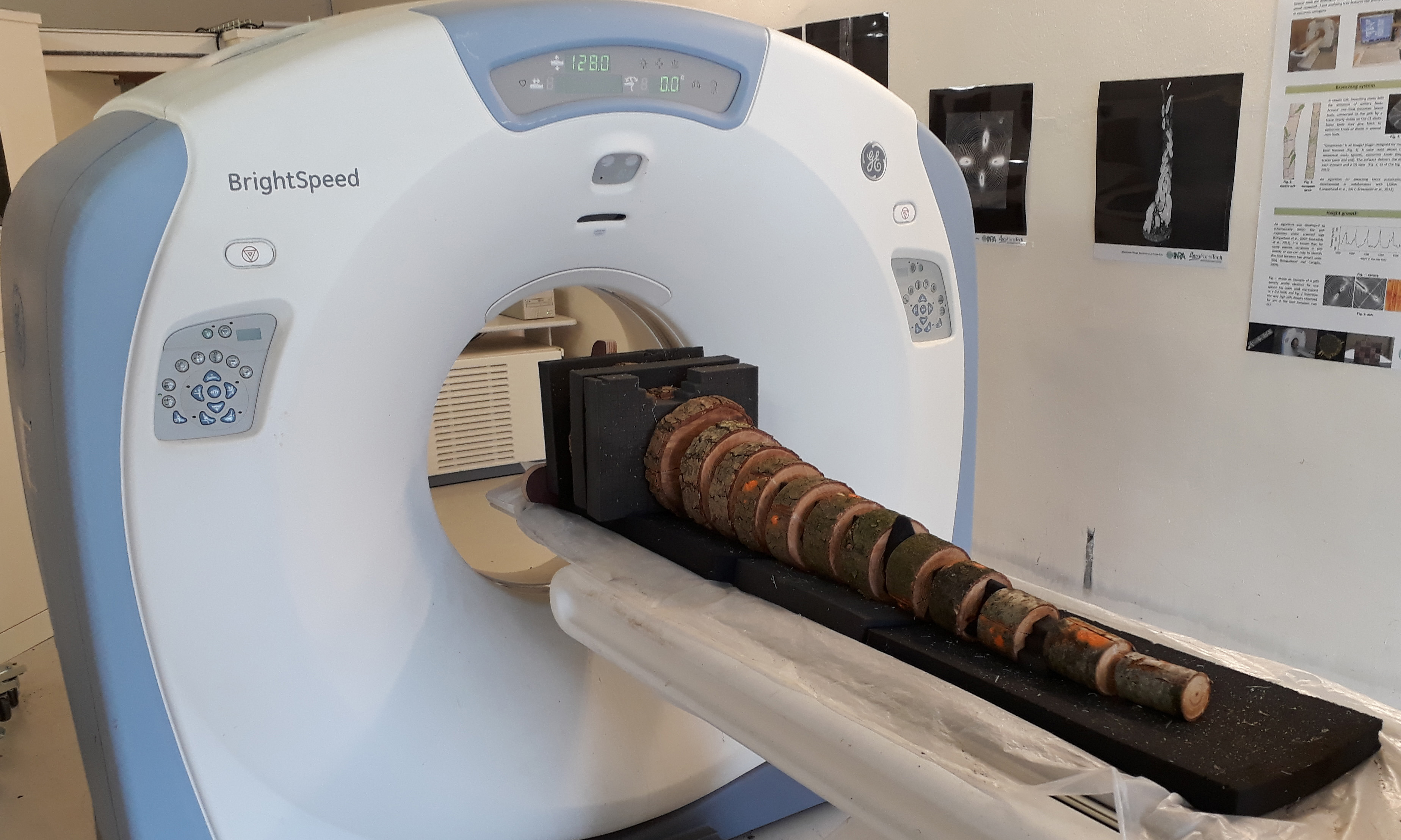 scanner à rayons X